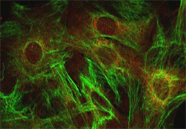 Cells believed to play a role in the progression of ALS. BenevolentBio used deep learning to find two possible treatments. Image courtesy of Oregon State University.
